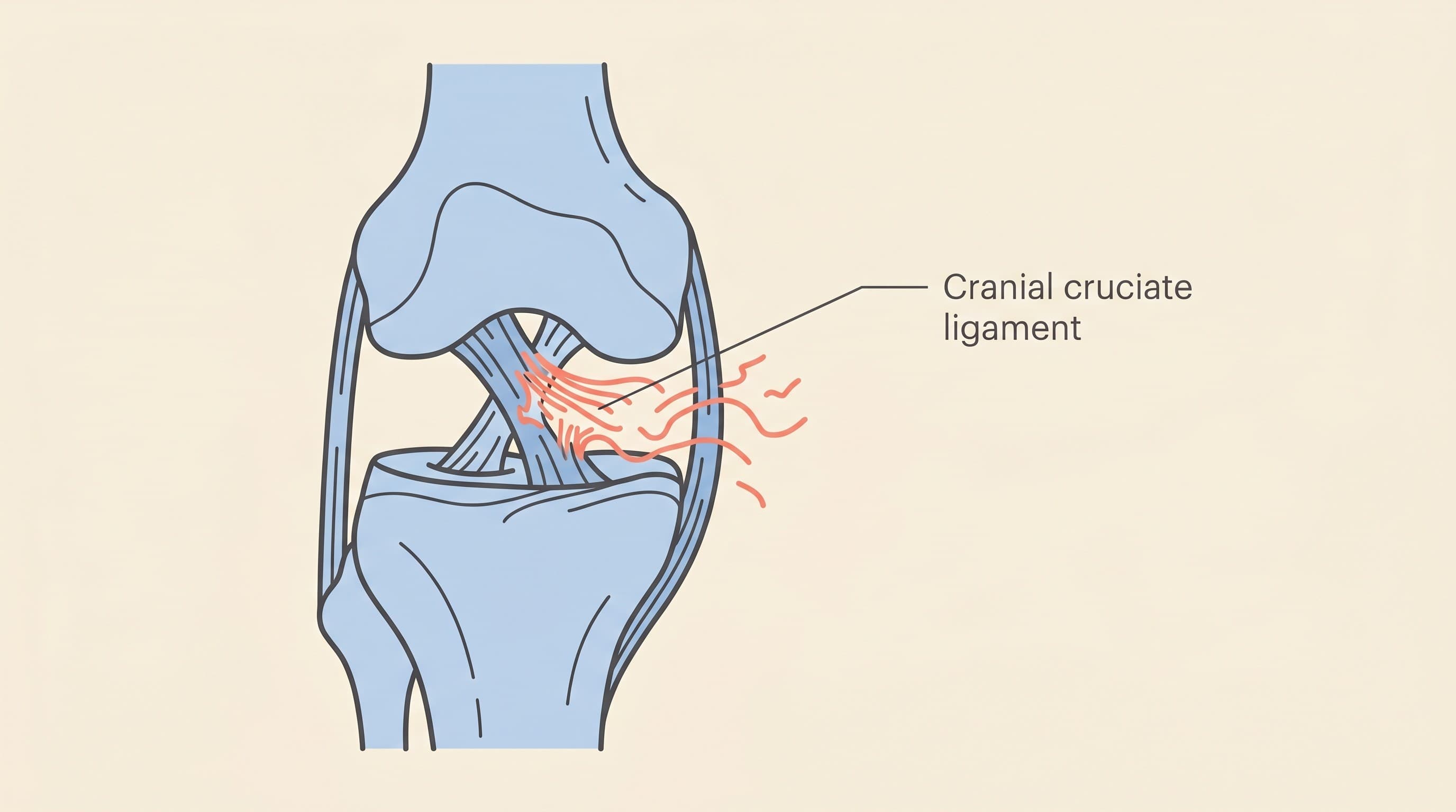 Why It's Degeneration, Not an Injury