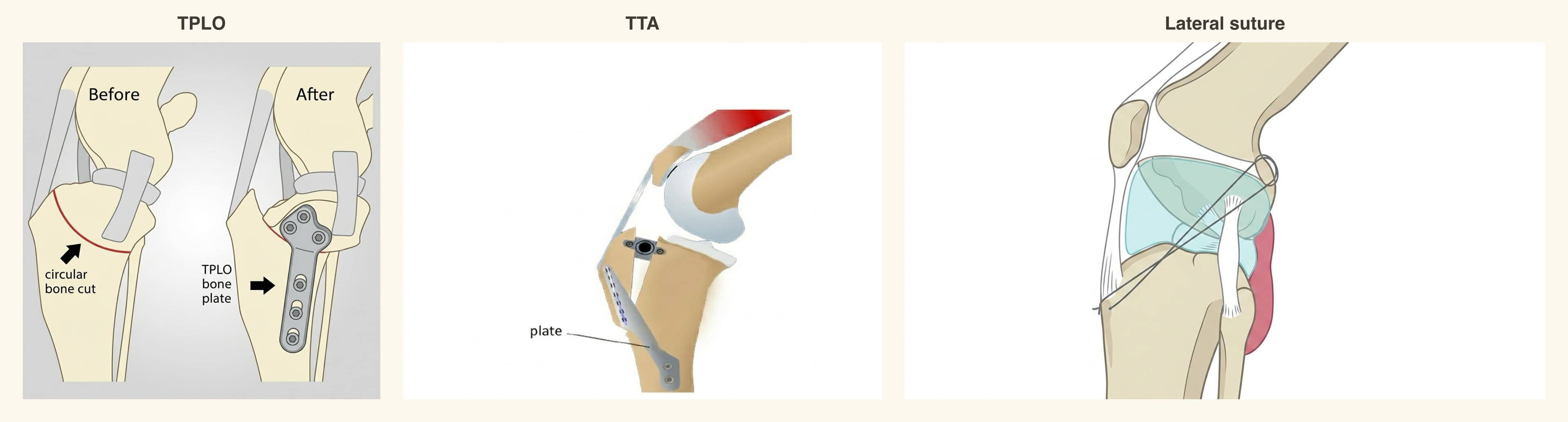 TPLO vs TTA vs Lateral Suture: An Even-Handed Comparison