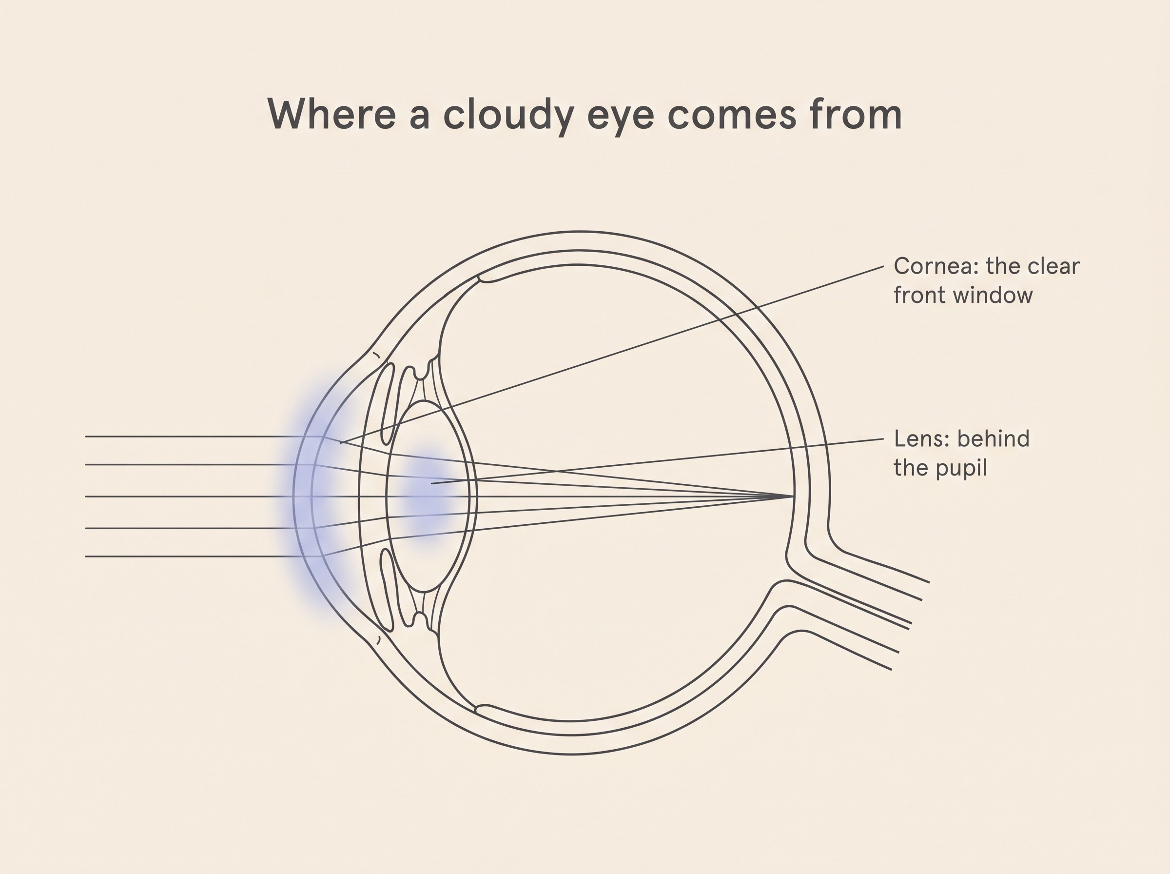 Flat cross-section of a pet's eye on cream showing the two places a cloudy eye can come from: the cornea, the clear front window at the front, and the lens, sitting just behind the pupil