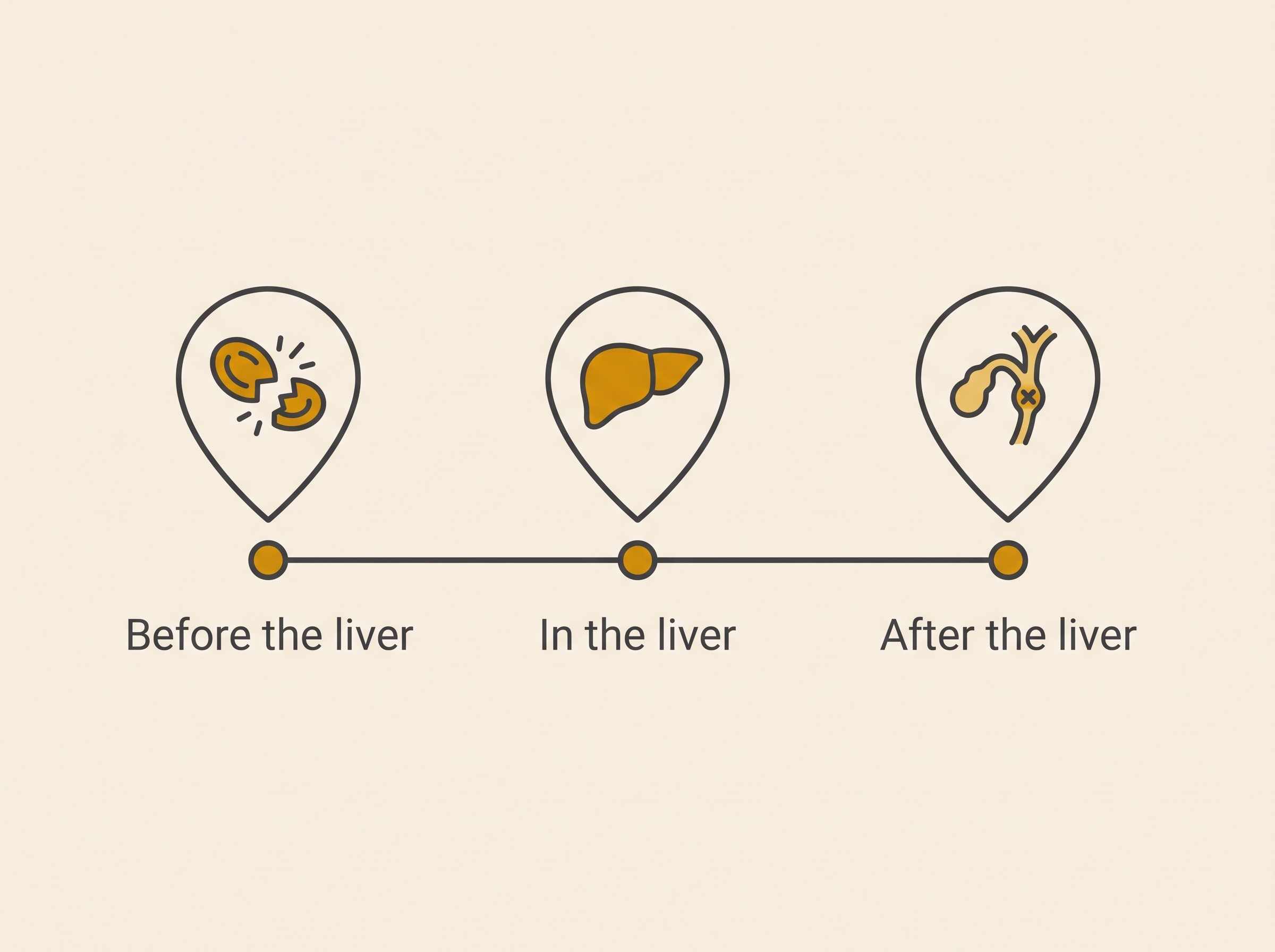 A gentle flat-vector diagram showing the three points where jaundice can arise, before, in, and after the liver, along a simple bilirubin pathway, warm cream background, soft charcoal linework, restrained warm-gold accent