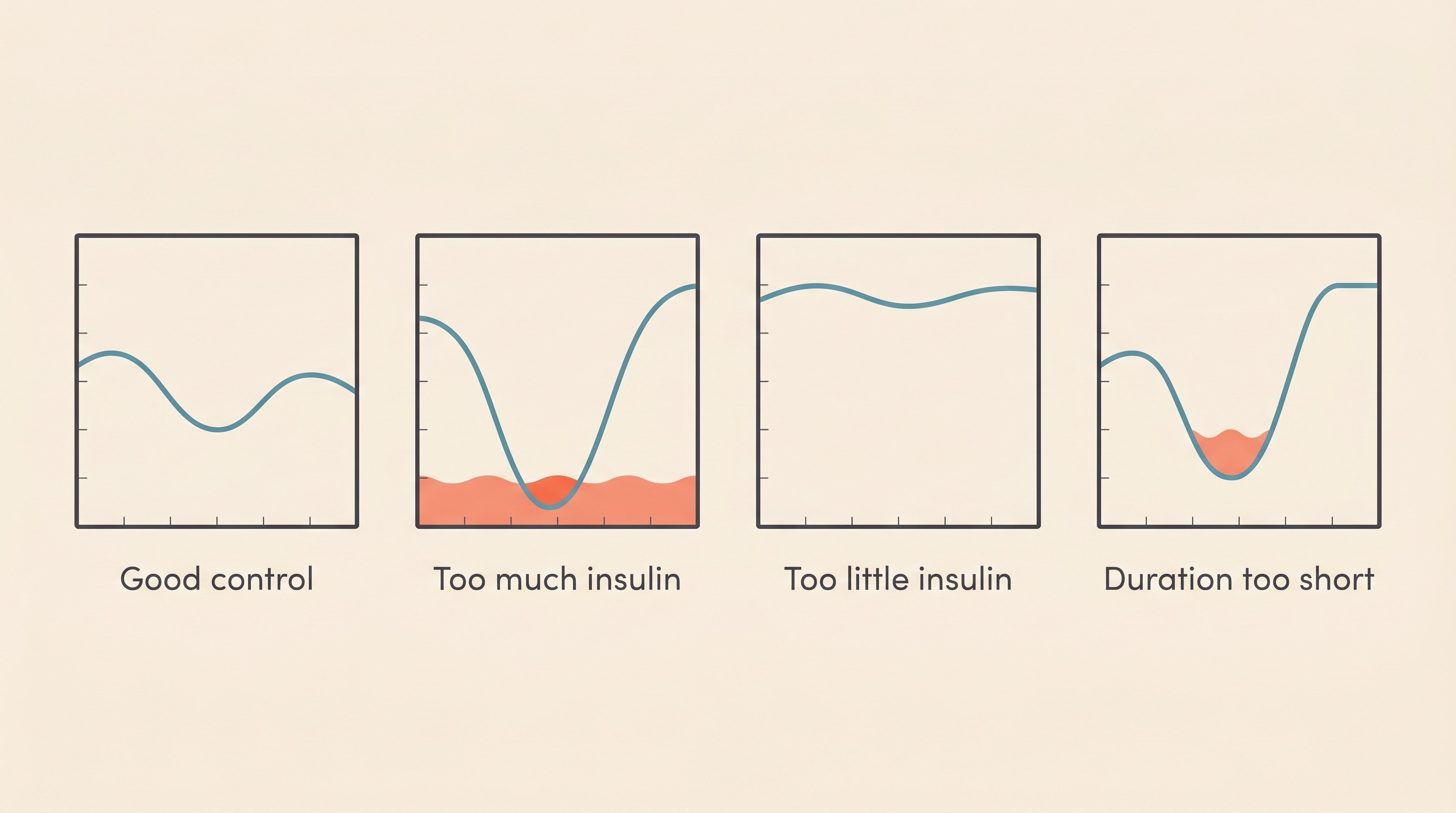 Four small annotated curves side by side on a cream background, labelled good control, too much insulin with nadir too low then rebound, too little insulin staying high, and duration too short dipping then climbing early