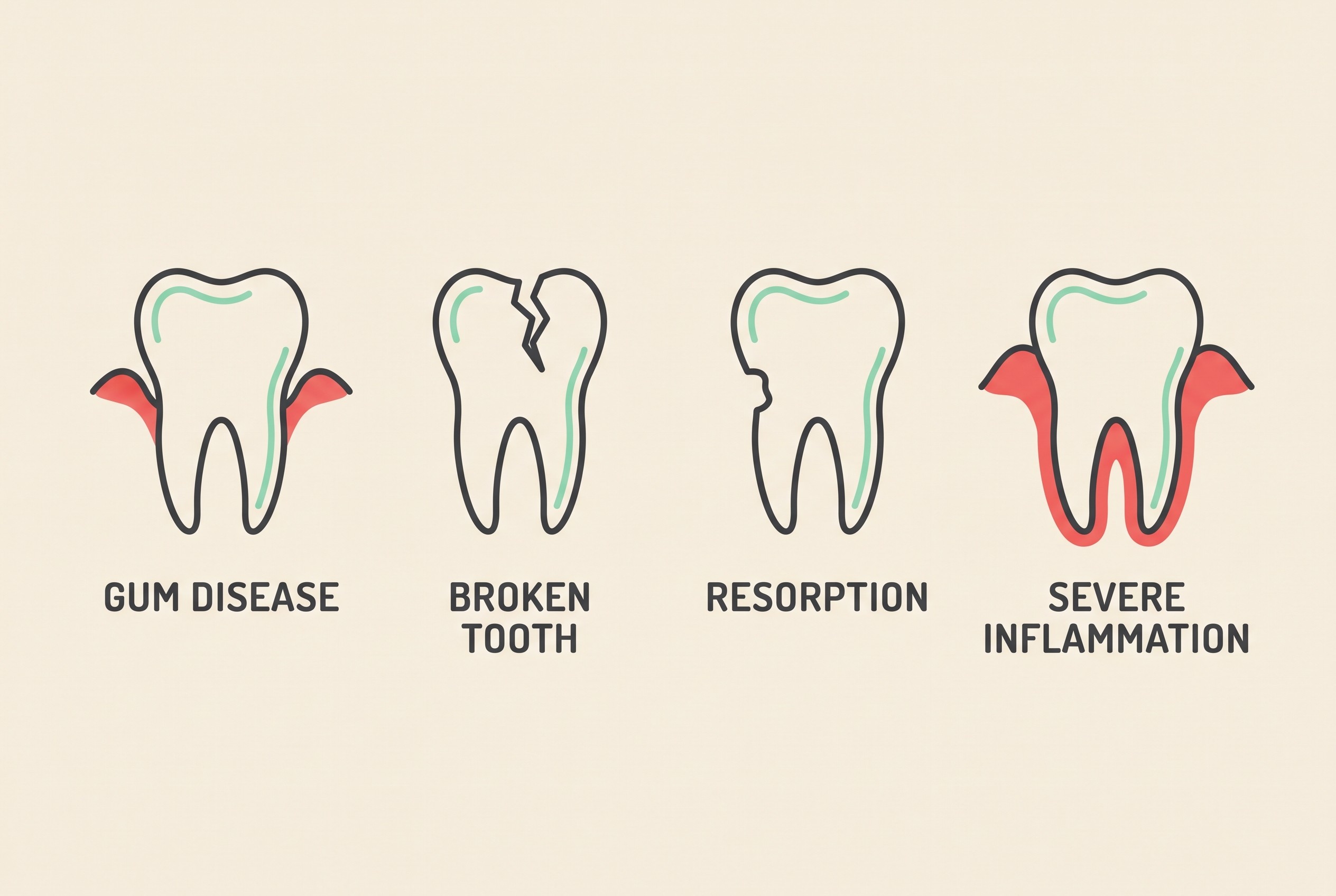 A row of four simple flat icons on cream with mint accents, labelled "GUM DISEASE", "BROKEN TOOTH", "RESORPTION" and "SEVERE INFLAMMATION".