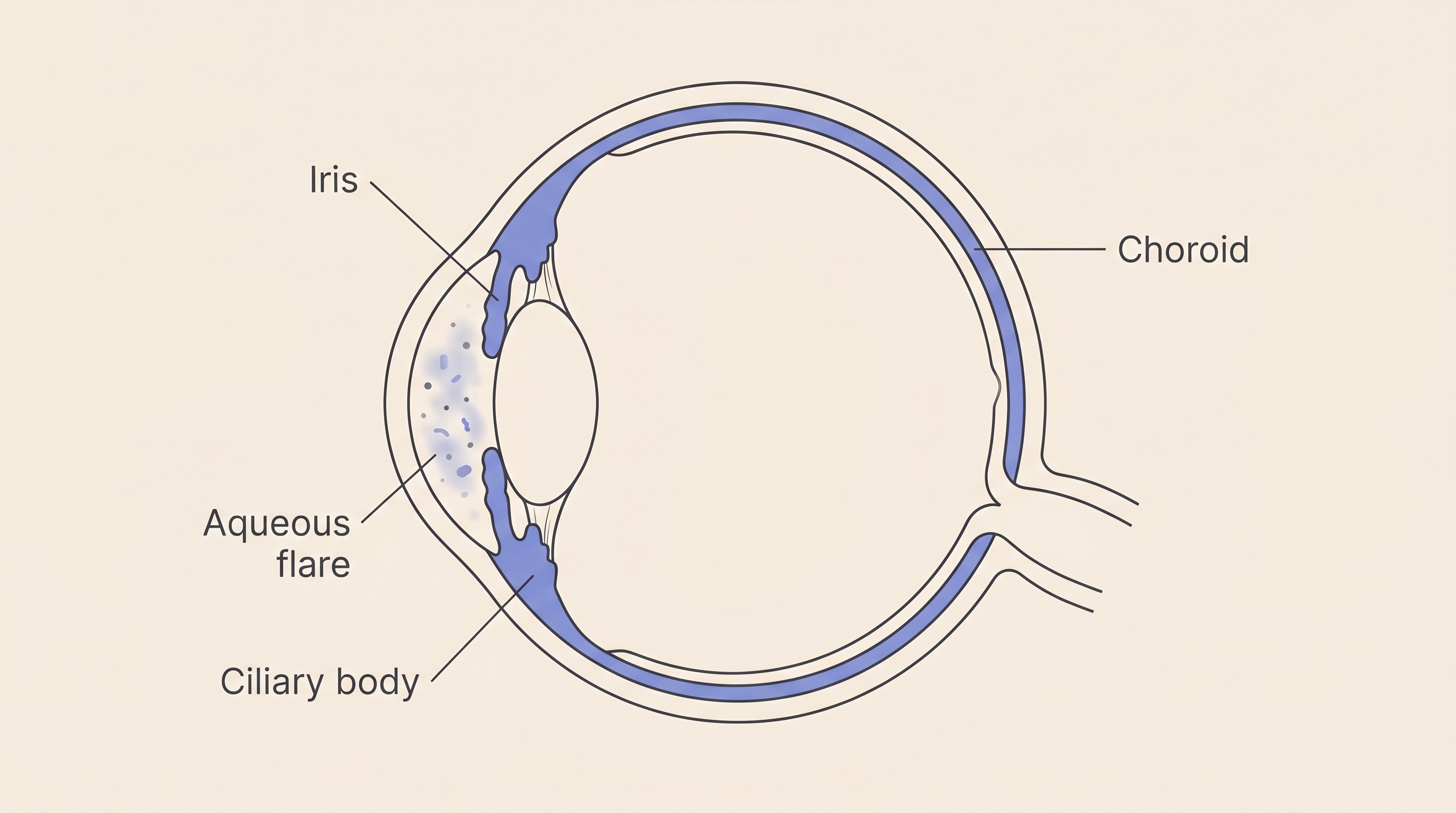 Cross-section flat illustration of a dog and cat eye on cream, the iris, ciliary body and choroid highlighted as the inflamed middle layer, with hazy cells drawn drifting into the front chamber